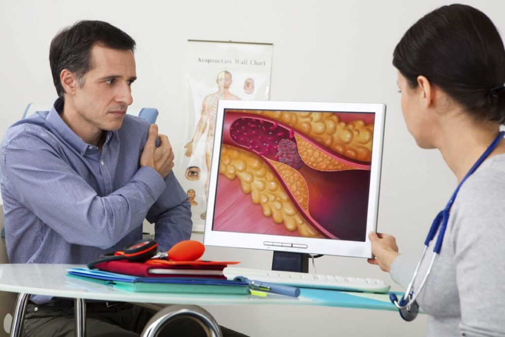 эффективное лечение атеросклероза